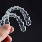 Aparat nakładkowy Invisalign Warszawa